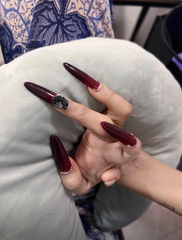 Những ngón tay cũng không được lành lặn như người bình thường.