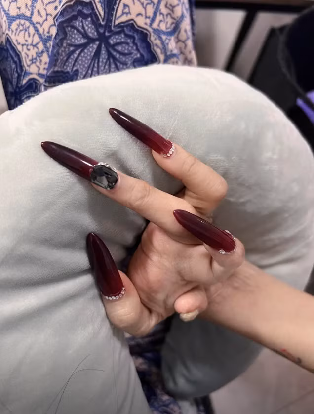 Những ngón tay cũng không được lành lặn như người bình thường.