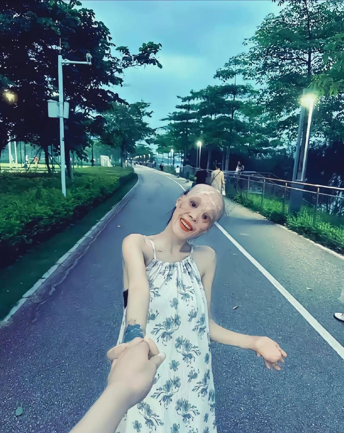 Tuy nhiên, sự thật hoàn toàn không phải như vậy. Theo những gì được chính cô gái này đăng tải lên trang cá nhân, thì cô đã sống với gương mặt như thế này từ ngày bé. Như vậy hình ảnh cô gái xinh đẹp mà cư dân mạng đang đồn thổi là Tiểu Lý trước đây cũng không chính xác.