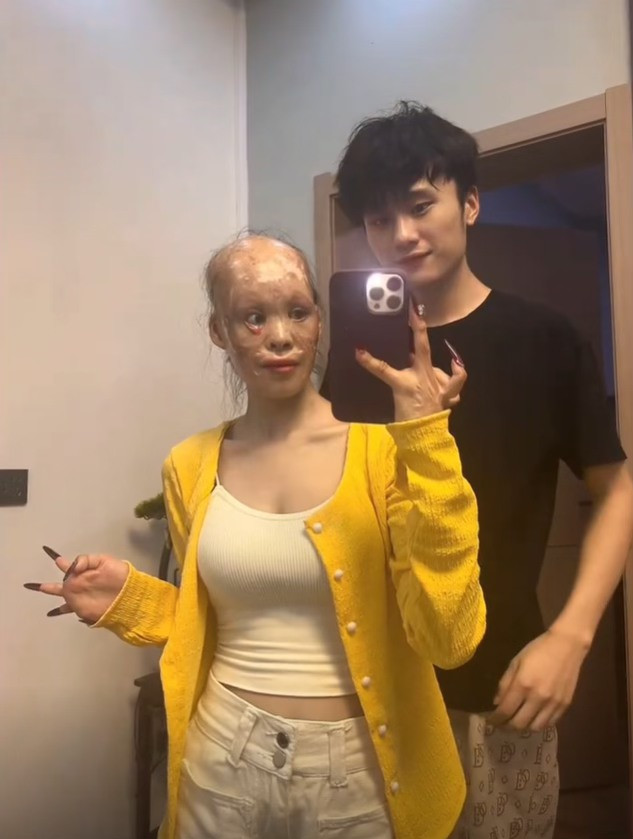 Sau khi biết được câu chuyện nói trên, không chỉ có cư dân mạng Trung Quốc mà ở Việt Nam cũng bày tỏ cực kỳ ngưỡng mộ với tình yêu bất chấp ngoại hình của cặp đôi này.