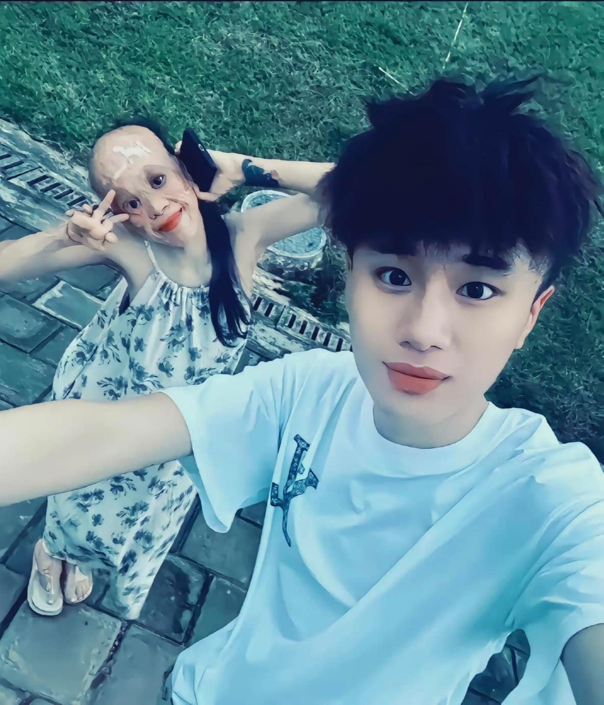 Cô gái với gương mặt gần như bị biến dạng hoàn toàn, trông khá...đáng sợ.