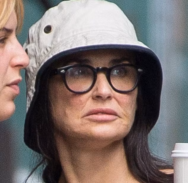 Khuôn mặt của cô không chỉ nhăn nhúm hơn bình thường và còn bị nổi cục trên da mặt. Nhiều người nghi ngờ đây là hậu quả của nhiều lần dao kéo, tiêm Botox của ngôi sao Hollywood.