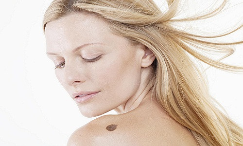 Vết bớt xuất hiện phía sau vai trái có nghĩa là chủ nhân sẽ gặp khó khăn về tiền bạc.