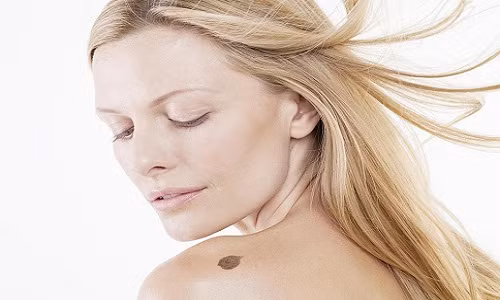 Vết bớt xuất hiện phía sau vai trái có nghĩa là chủ nhân sẽ gặp khó khăn về tiền bạc.