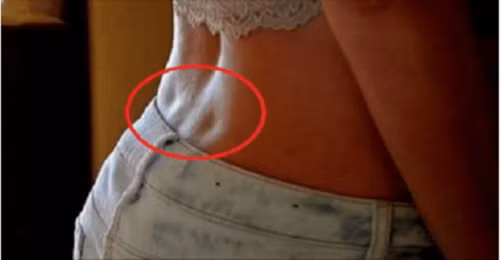 "Lúm đồng tiền" sau lưng là dấu hiệu của cơ thể khỏe mạnh, có sức khỏe tốt vì những người này có quá trình trao đổi chất tốt hơn.