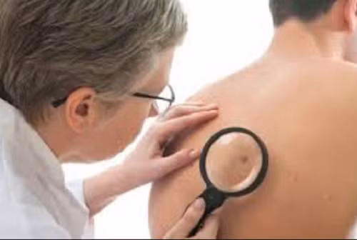 Khi xem dấu hiệu đặc biệt trên lưng mà thấy vết bớt ở giữa lưng là dấu hiệu may mắn. Người có vết bớt đặc biệt này gặp nhiều quý nhân phù trợ. Cuộc sống thuận buồm xuôi gió, về già hưởng phú quý cùng con cháu.