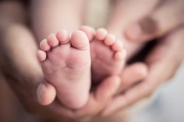 Hai trường hợp mắc hội chứng người cá nổi tiếng thế giới là Tiffany Yorks ở Mỹ và Milagros Cerron ở Peru.