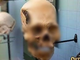 Trong số các hiện vật được lưu giữ và trưng bày tại bảo tàng Osteology ở bang Oklahoma, Mỹ, một hộp sọ 2.000 tuổi dị thường được giới chuyên gia và công chúng hết sức quan tâm.