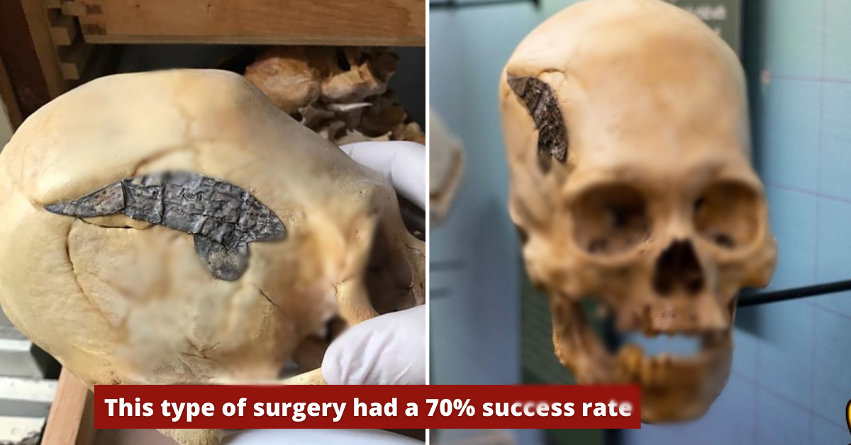 Từ đây, các chuyên gia nghiên cứu vì sao chiến binh này lại có hộp sọ đặc biệt như vậy. Thông qua một loạt kiểm tra và phân tích hộp sọ, họ nhận định chiến binh này từng bị chấn thương nặng ở phần đầu trong một trận chiến.