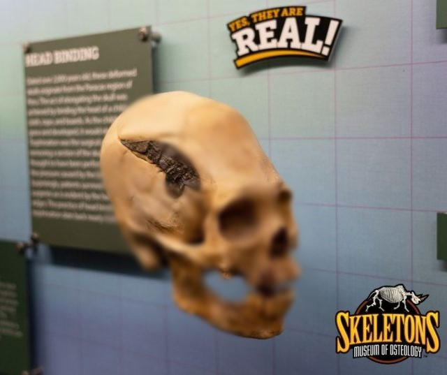 Người đàn ông này có thể bị thương ở đầu do bị kẻ thù dùng súng cao su bắn trúng.