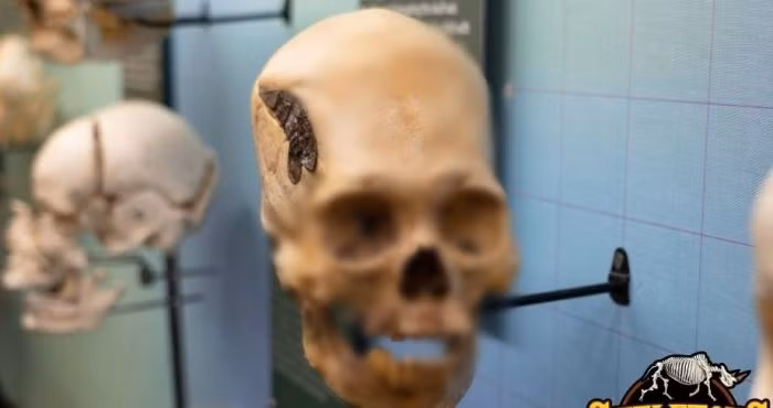 Do đó, hộp sọ của người đàn ông này trở thành bằng chứng quan trọng cho thấy người xưa có khả năng thực hiện các ca phẫu thuật não phức tạp.