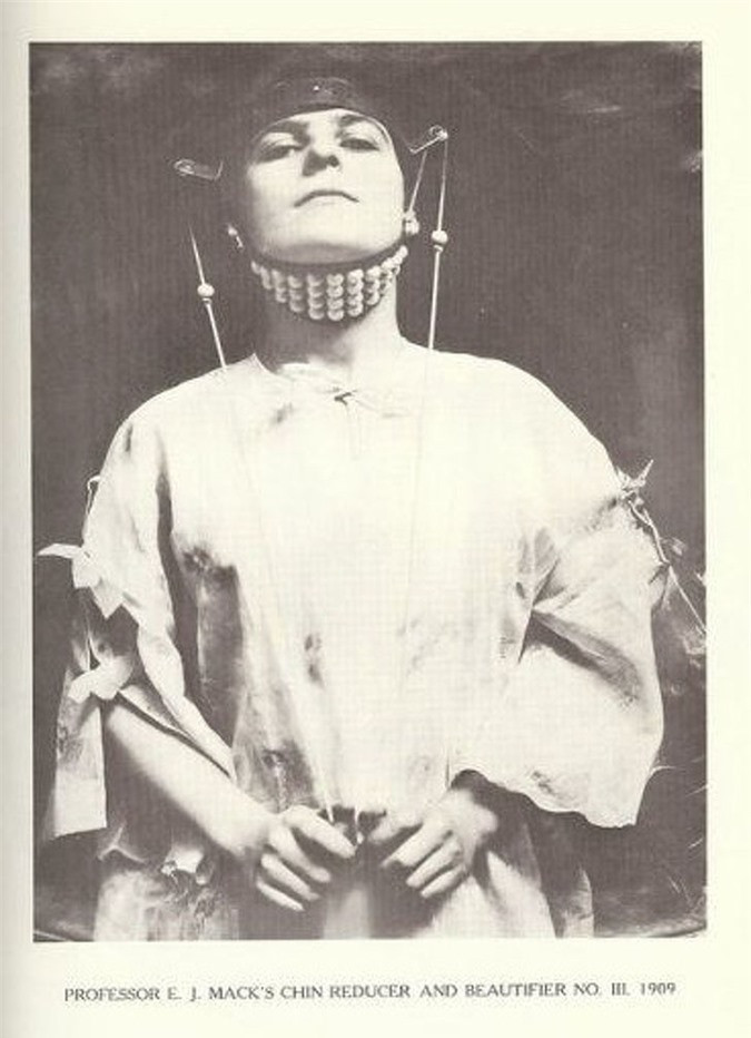  Dụng cụ kéo cằm: Vào những năm 1890, giáo sư EJ Mack đã tạo ra một thiết bị đặc biệt giúp loại bỏ một cằm đôi. Tuy nhiên, thiết bị này trông giống như đồ tra tấn.