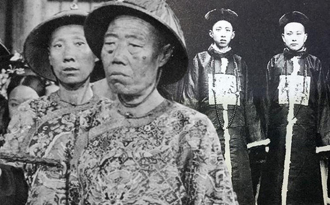 Nhưng, đái dầm và thấm nước tiểu ra quần là chuyện không thể tránh khỏi. Trong xã hội phong kiến, người dân thường sử dụng những câu từ khó chịu và kinh tởm nhất để mô tả mùi hôi từ cơ thể của thái giám. Có những lúc đứng cách xa 300 mét còn có thể ngửi thấy những mùi hôi đó. Tuy nhiên, mỗi thái giám có một mùi hôi khác nhau. Không ít người cho rằng, thái giám trên người có mùi nồng nặc đều là những thái giám cấp thấp, rất khác với các thái giám ở cạnh hoàng đế mỗi ngày.