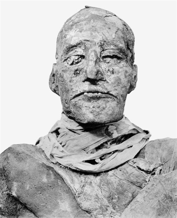 Không chỉ bị cắt cổ, một lần chụp CT khác cũng đã phát hiện ra ngón chân bên trái của vua Ramses III bị chặt bởi một chiếc rìu ngay trước khi ông chết. Điều này khiến cho các nhà nghiên cứu đặt giả thiết có thể có nhiều người cố giết ông bằng nhiều thứ vũ khí khác nhau.