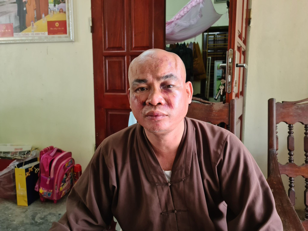 Su chua Thien Mu o Hai Phong bi hai nguoi danh vo xuong mui