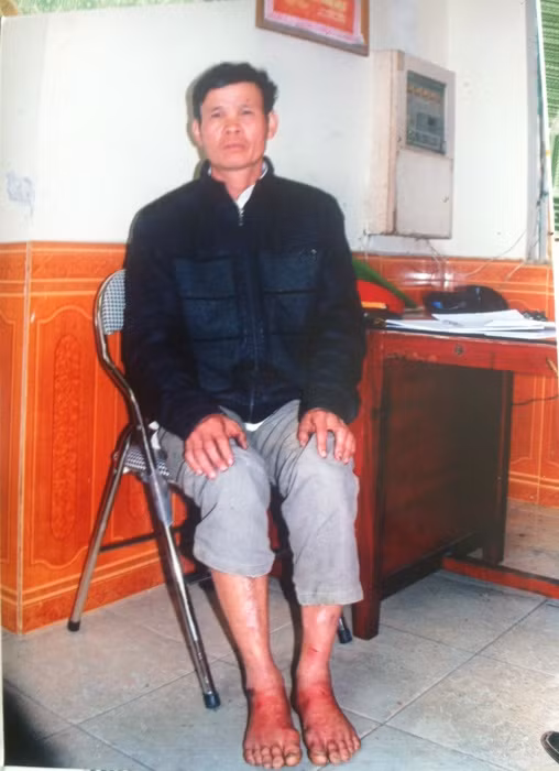 Hai Duong: Dan to cong an huyen dung nhuc hinh de ep cung?