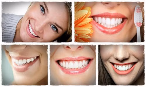 Bi quyet de ham rang trang bong khong can den nha si