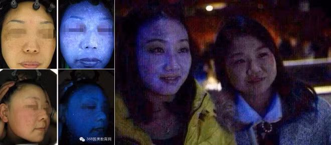 Lam dep tu mat na giay gia re co the gay ung thu da-Hinh-2