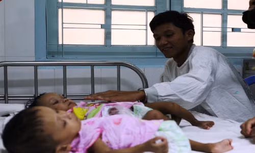 Tach thanh cong cap song sinh dinh lien hy huu nhat Viet Nam