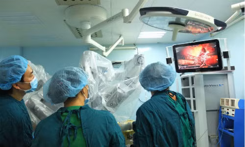 Chuyen la o Viet Nam: Dung Robot dieu tri ung thu gan