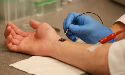 Buoc tien y hoc: Phat minh con chip cong nghe nano tai tao te bao