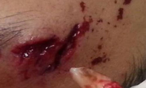 Hai hung rang nanh cam trong tran sau khi va cham xe