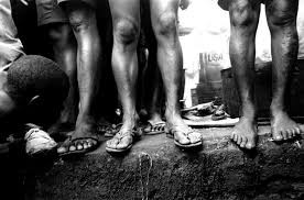 Trên thực tế, nhiều tù nhân tại nhà tù khắc nghiệt này mắc các bệnh nhiễm trùng do thường xuyên phải đứng ở những nơi có chất cặn lắng, chất thải.