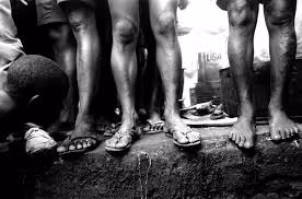 Trên thực tế, nhiều tù nhân tại nhà tù khắc nghiệt này mắc các bệnh nhiễm trùng do thường xuyên phải đứng ở những nơi có chất cặn lắng, chất thải.