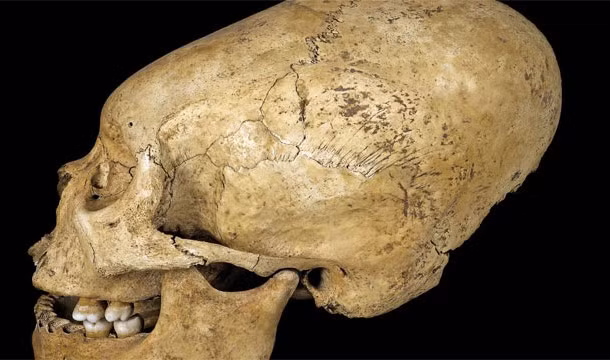 Người Inca đã thực hiện một số nghi lễ kỳ lạ khiến hộp sọ bị biến dạng. Theo một số tài liệu, người Inca quấn vải xung quanh đầu của trẻ em khiến hộp sọ của đứa trẻ đó dài ra.