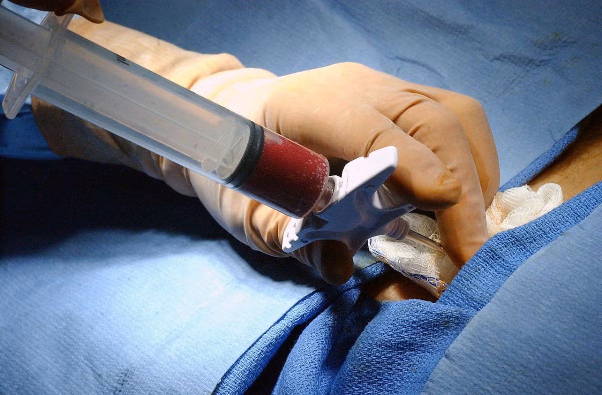  Trước cấy ghép tủy, các bác sĩ sẽ tiến hành liệu pháp điều trị hóa, nhằm tiêu diệt các tế bào bệnh, tạo khoảng trống trong tủy cho các tế bào ghép trú ngụ và sinh sản và chuẩn bị sức khỏe đến khi đủ điều kiện các bác sĩ sẽ thực hiện ghép tủy. 