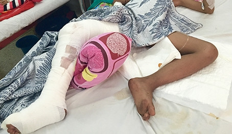 Dut day than kinh, mach mau do khi can