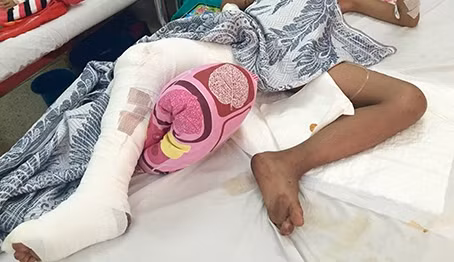 Dut day than kinh, mach mau do khi can