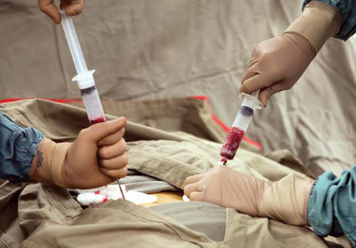  Nguồn tủy để ghép sẽ được lấy từ người thân trong gia đình có chung nguồn gien với bệnh nhân; từ người tình nguyện hiến tủy và có thể lấy từ ngân hàng tế bào gốc, tức là từ những người hiến tủy ở nơi khác. 