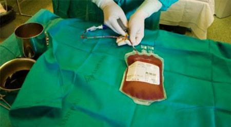 Sau ghép tủy, người bệnh sẽ được theo dõi kỹ, sát sao để đảm bảo các tế báo gốc mới hòa nhập với tủy xương và bắt đầu sản xuất tế bào máu mới; cũng như xử lý ngay khi có các biểu hiện thải ghép. 