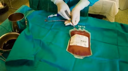 Sau ghép tủy, người bệnh sẽ được theo dõi kỹ, sát sao để đảm bảo các tế báo gốc mới hòa nhập với tủy xương và bắt đầu sản xuất tế bào máu mới; cũng như xử lý ngay khi có các biểu hiện thải ghép. 