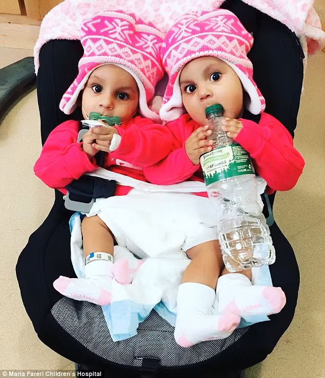 Được biết, cặp song sinh đến từ Cộng hòa Dominica này chào đời hồi tháng 2/2016. Cha mẹ cặp song sinh này không hề biết 2 bé bị dị tật dính liền.