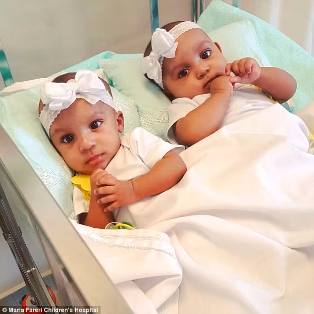 Bellanie và Ballanie sinh ra đã dính liền hệ tiêu hóa, các cơ quan sinh sản, phần dưới tủy sống . Các bác sĩ cho biết nếu phẫu thuật tách rời họ chỉ có 23% cơ hội sống sót.