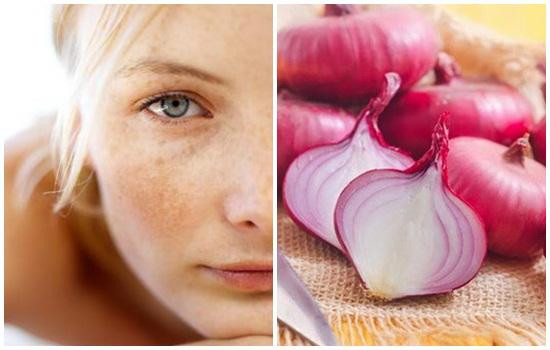 Hướng dẫn chị em cách trị nám và tàn nhang bằng nước ép hành. Ảnh: Internet