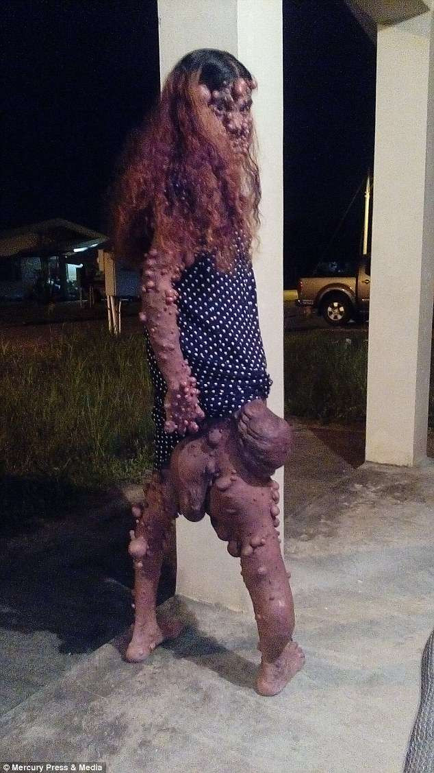 Do ngoại hình gây ác cảm, Charmaine không thể tìm được việc làm, gặp khó khăn về tài chính, người thân và bạn bè cũng không muốn liên lạc với cô. Những đứa trẻ con cô cũng không dám mời bạn bè tới nhà. Charmaine thường cố gắng không đi ra ngoài. Thế nhưng cô vẫn phải tới siêu thị mua đồ hoặc đến một số địa điểm cần thiết.