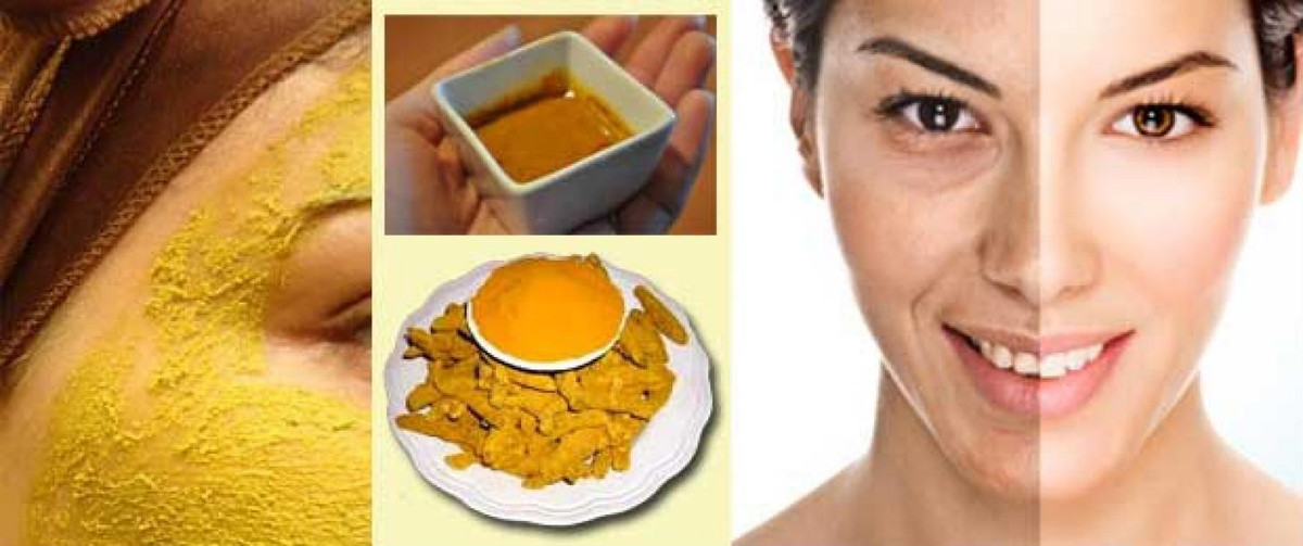 Chữa nám và tàn nhang nhanh chóng bằng bột nghệ tại nhà. Ảnh: Internet