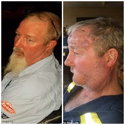 Tuy nhiên, những cuộc phẫu thuật liên tiếp khiến gia đình ông khuynh gia bại sản. Ông đã phải bán ô tô, nhà cửa của mình để trang trải cho việc nợ nần. Hiện gia đình ông đang cố gây quỹ cho những cuộc phẫu thuật tiếp theo.