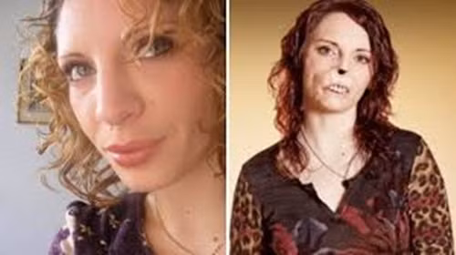 Quyết định rằng mình sẽ không sống độc thân cả đời, Tammy cũng nhận thức được rằng trong khi trước kia cô chưa từng gặp khó khăn trong việc thu hút sự chú ý của đàn ông thì giờ đây có những người sẽ chỉ nhìn vào mỗi những vết sẹo của cô mà thôi.