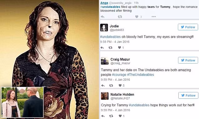 Bất chấp ngoại hình khác thường của Tammy, vào một ngày lãng mạn, Gary đã tỏ tình cô trên sóng truyền hình. Khán giả đã vô cùng cảm động trước tấm chân tình của chàng trai dành cho cô gái trẻ. Những lời chúc mừng bay tới tấp đến instagram của cả hai người và hy vọng một đám cưới cổ tích trong tương lai không xa.