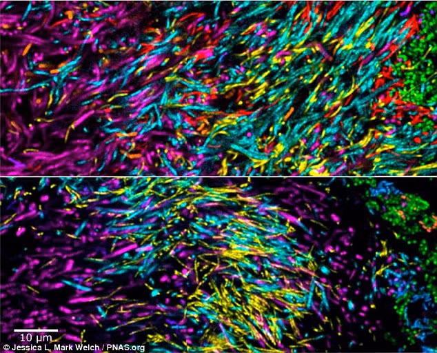 Những hình ảnh nhiều nhất là vi khuẩn bạch hầu (Corynebacterium) đóng vai trò trụ cột và xung quanh nó là các liên cầu khuẩn (Streptococcus) bám vào như tán lá cây.