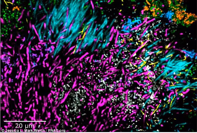 Sử dụng dữ liệu trên kính hiển vi kết hợp hình ảnh huỳnh quang phổ, các nhà khoa học đã phát hiện tập đoàn vi khuẩn multigenus trong mảng bám răng của người.