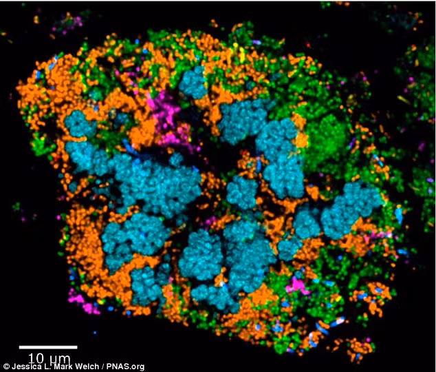 Miệng con người là nơi sản sinh vi trùng. Sẽ có cả ổ vi khuẩn bám trên răng nếu bạn không vệ sinh răng sạch sẽ.