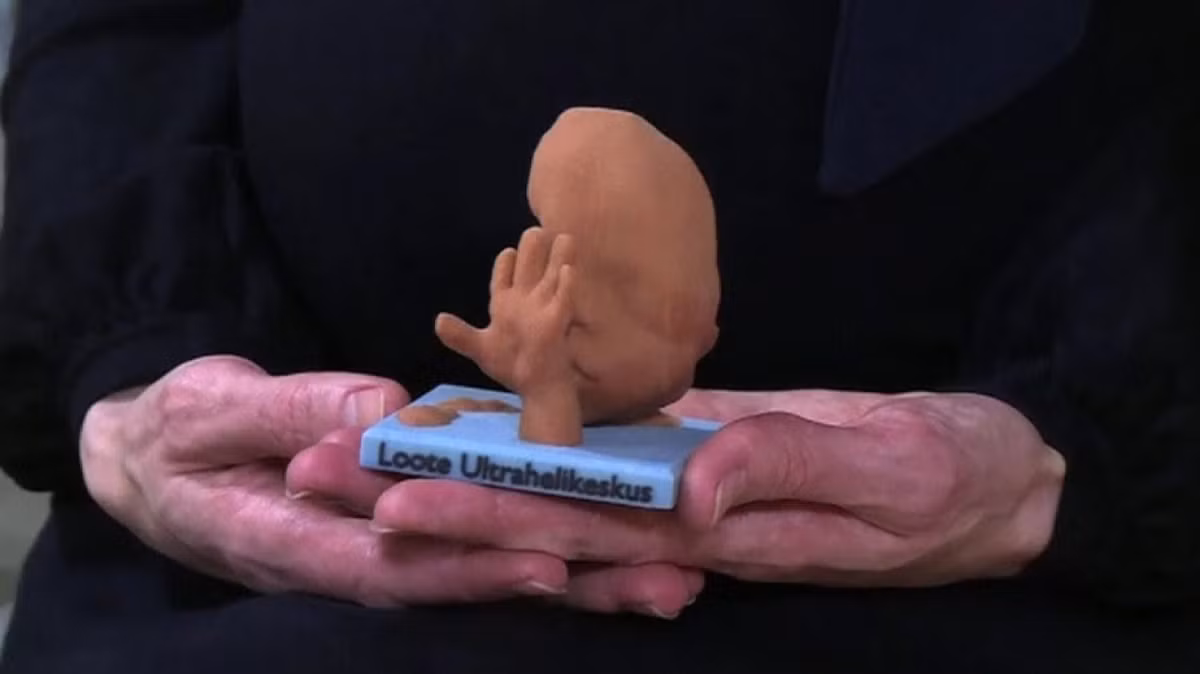 Mô hình bào thai 3D này có giá khá đắt, gần 5 triệu đồng.