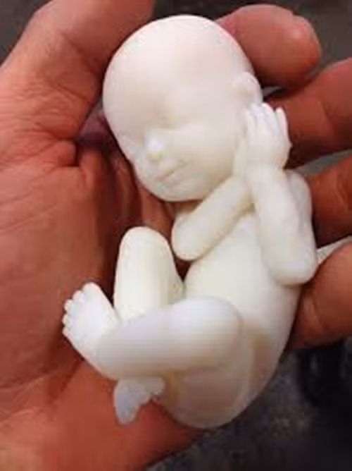 Đây là cách thực sự độc đáo để chia sẻ sự phấn khích của em bé với gia đình, bạn bè. Bản in 3D cũng giúp ích cho nhiều phụ nữ mất thị thực có thể hình dung và liên kế với em bé của họ.