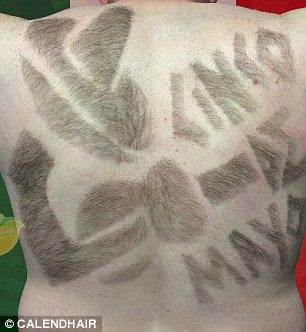 Anh kể lại, thời học trung học thường xuyên là trò mua vui cho bạn bè sau khi họ phát hiện lông trên cơ thể phát triển không giống như người bình thường.