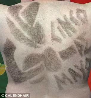 Anh kể lại, thời học trung học thường xuyên là trò mua vui cho bạn bè sau khi họ phát hiện lông trên cơ thể phát triển không giống như người bình thường.